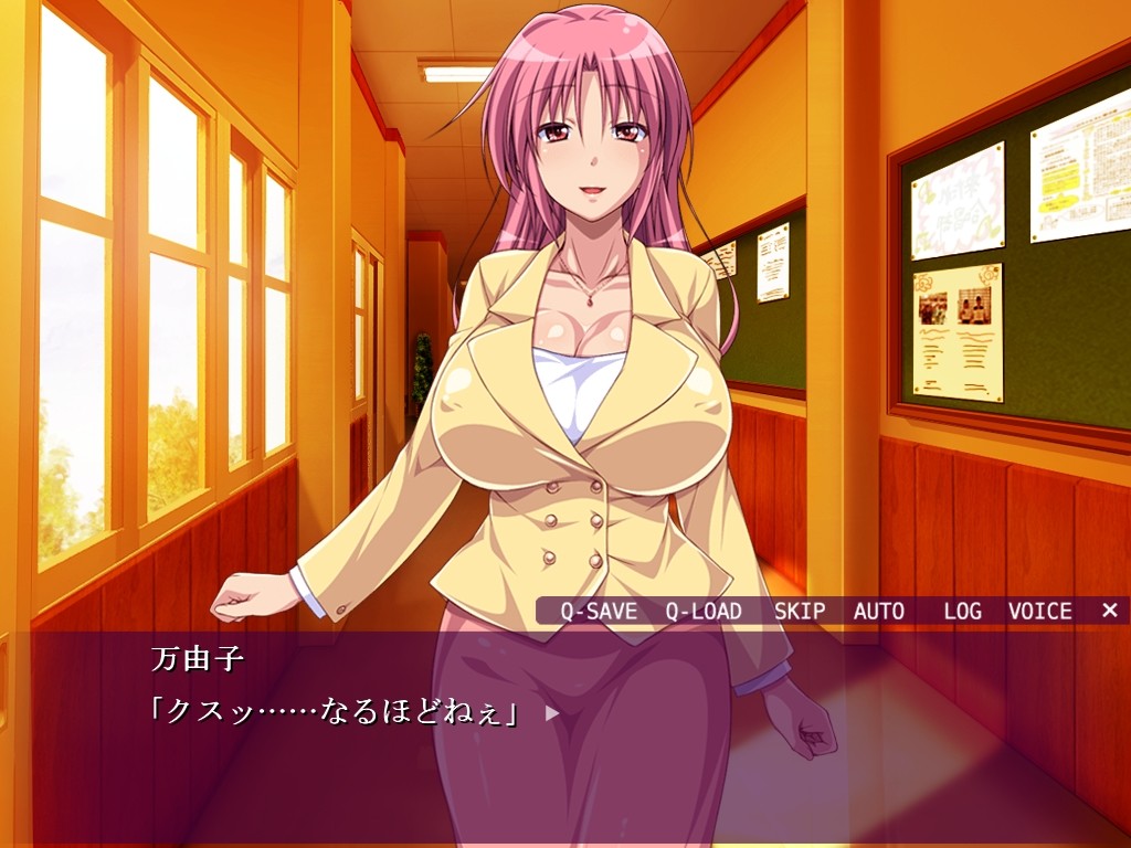 나의 은사는 똥빗치