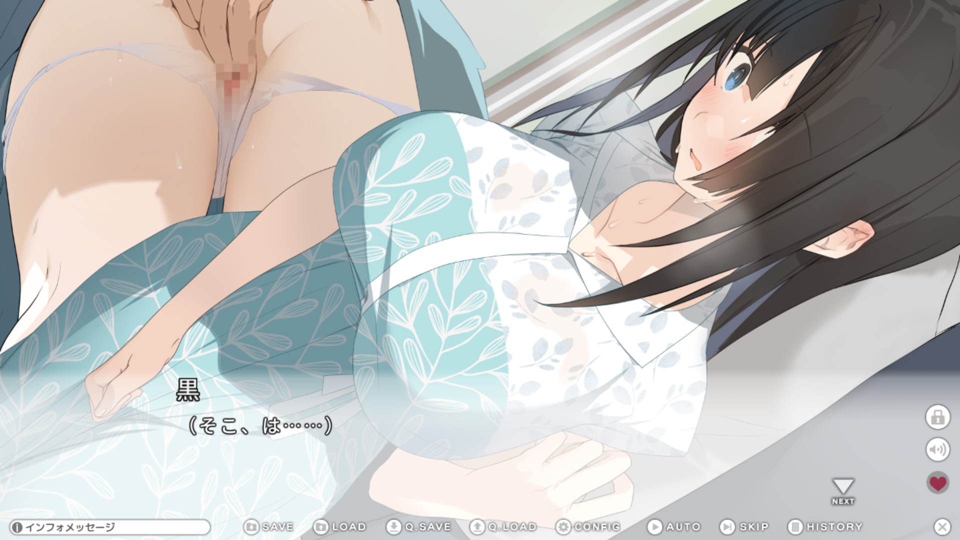 시로쿠로 ～색정증 소꿉친구를 돌보게 되었다, 그녀에게는 비밀로～